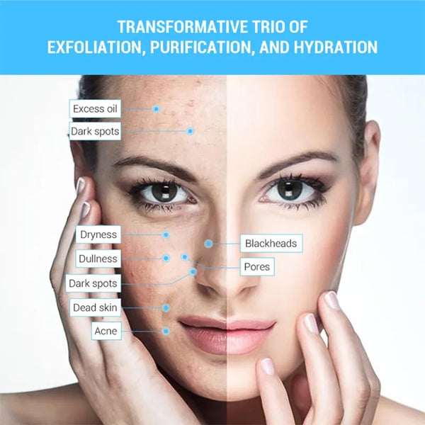 3 IN 1 Diamond Water Spray - Blackhead Microdermabrasion Facial Beauty Machine