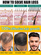 Rapid Hair Growth Essential Oil - Baldness Repair Solution