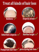 Rapid Hair Growth Essential Oil - Baldness Repair Solution